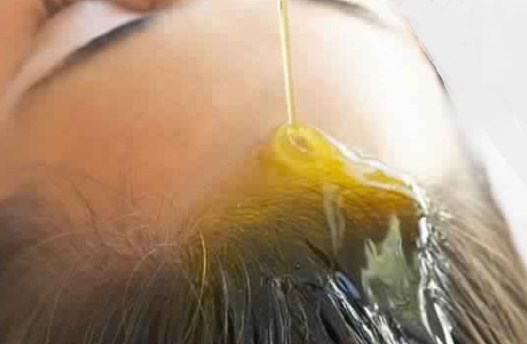 Les bienfaits de l’huile de ricin sur les cheveux et sur la peau